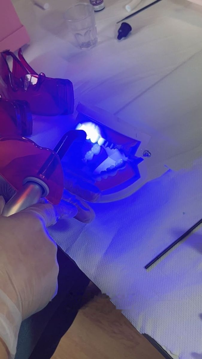 La lampe du kit de blanchiment allumée pendant une pratique