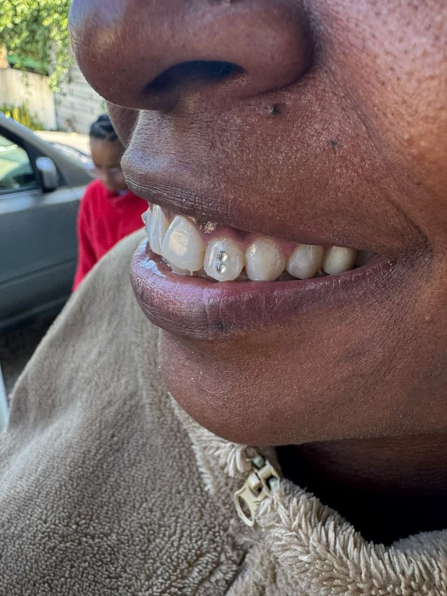 Un sourire avec des strass posés sur les dents