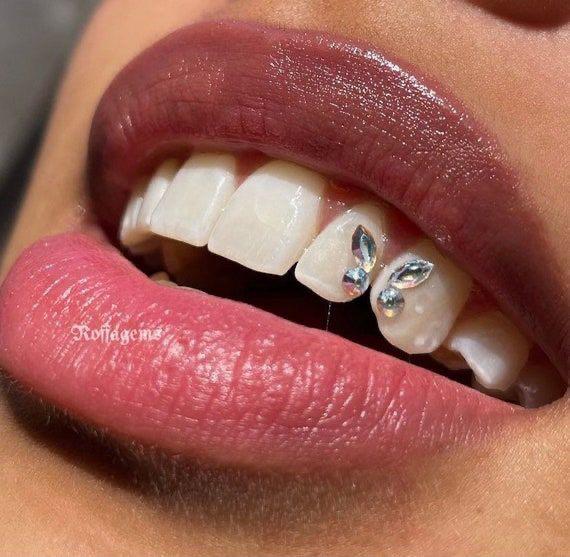 Des strass en forme de papillon posés sur deux dents