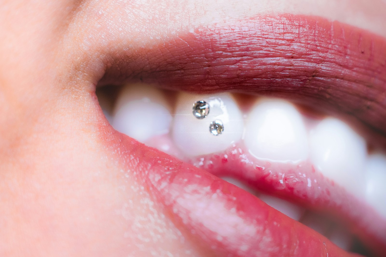 Sourire avec deux petits strass posés sur une dent